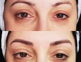 Beauty Esteem | Dauerhafte Haarentfernung | Microblading